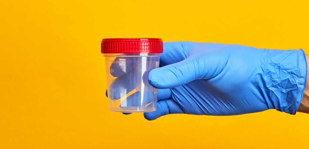 Person holds urine test cup